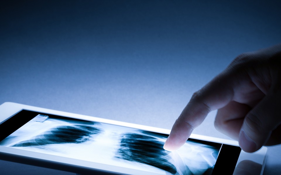 Radiology Xray on tablet